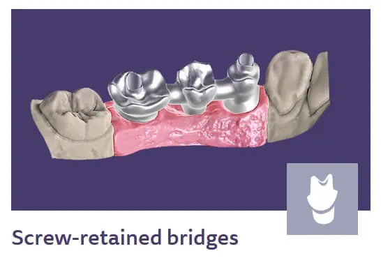 screw-retained-bridges